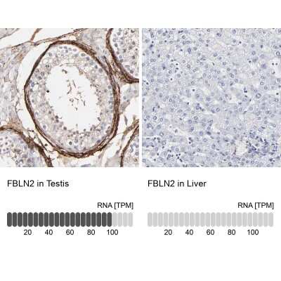 Immunohistochemistry-Paraffin: Fibulin 2 Antibody [NBP1-88115]