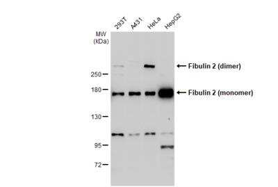 Western Blot: Fibulin 2 Antibody [NBP1-33479]