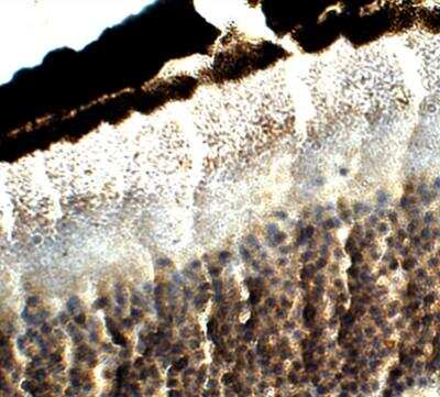 Immunohistochemistry-Paraffin: Fibulin-3/EFEMP1 Antibody [NB300-691]