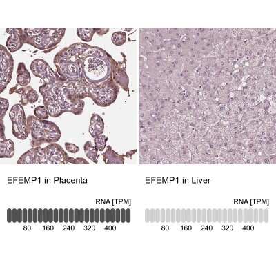 Immunohistochemistry-Paraffin: Fibulin-3/EFEMP1 Antibody [NBP2-57871]