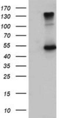 Western Blot: Fibulin-3/EFEMP1 Antibody (OTI1D9)Azide and BSA Free [NBP2-70700]