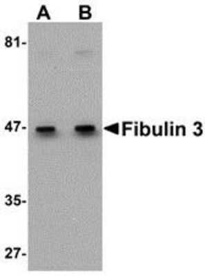 Western Blot: Fibulin-3/EFEMP1 AntibodyBSA Free [NBP1-77040]