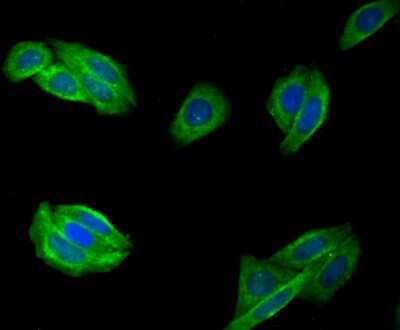 Immunocytochemistry/ Immunofluorescence: Fibulin 5/DANCE Antibody (2424) [NBP2-76929]