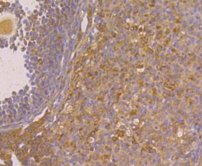 Immunohistochemistry: Fibulin 5/DANCE Antibody (2424) [NBP2-76929]
