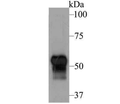 Western Blot: Fibulin 5/DANCE Antibody (2424) [NBP2-76929]