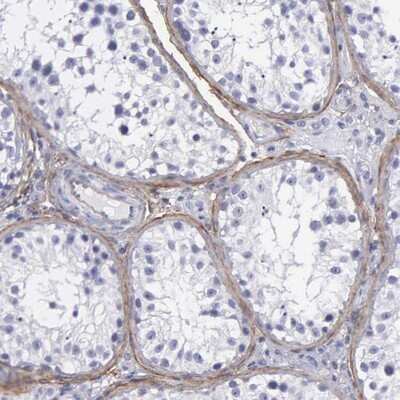 Immunohistochemistry-Paraffin: Fibulin 5/DANCE Antibody [NBP1-90100]