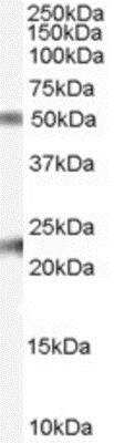 Western Blot: Fibulin 5/DANCE Antibody [NB100-53783]