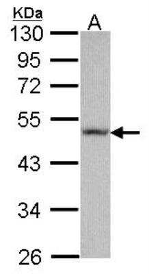 Western Blot: Fibulin 5/DANCE Antibody [NBP2-16495]