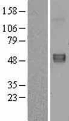 Western Blot: Fibulin 5/DANCE Overexpression Lysate [NBL1-10609]