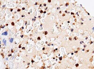 Immunohistochemistry-Paraffin: Ficolin-1 Antibody (017) [NBP2-89714]