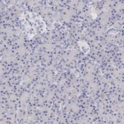 Immunohistochemistry-Paraffin: Ficolin-1 Antibody [NBP1-84705]