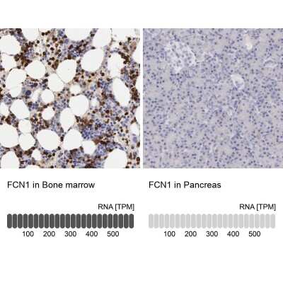 Immunohistochemistry-Paraffin: Ficolin-1 Antibody [NBP1-84705]