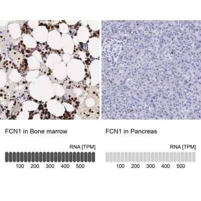 Immunohistochemistry-Paraffin: Ficolin-1 Antibody [NBP1-84706]