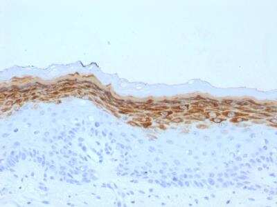 Immunohistochemistry-Paraffin: Filaggrin Antibody (FLG/1561) - Azide and BSA Free [NBP2-54366]