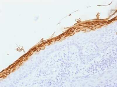 Immunohistochemistry-Paraffin: Filaggrin Antibody (FLG/1562) [NBP2-53245]