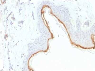 Immunohistochemistry-Paraffin: Filaggrin Antibody (FLG/1945) [NBP3-07376]