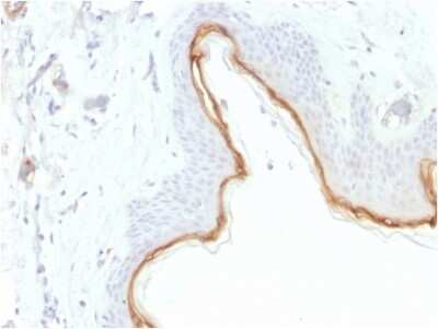 Immunohistochemistry-Paraffin: Filaggrin Antibody (FLG/1945) - Azide and BSA Free [NBP3-08355]