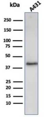 Western Blot: Filaggrin Antibody (FLG/3909R) [NBP3-13893]