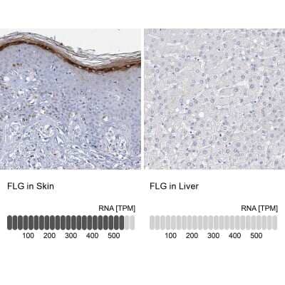 Immunohistochemistry-Paraffin: Filaggrin Antibody [NBP1-87527]