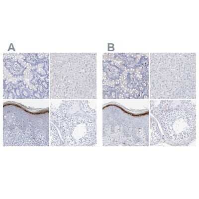 Immunohistochemistry-Paraffin: Filaggrin Antibody [NBP1-87527]