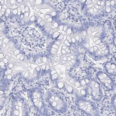 Immunohistochemistry-Paraffin: Filaggrin Antibody [NBP1-87527]