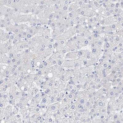 Immunohistochemistry-Paraffin: Filaggrin Antibody [NBP1-87527]