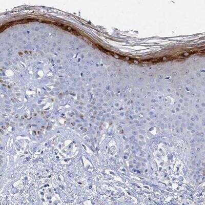 Immunohistochemistry-Paraffin: Filaggrin Antibody [NBP1-87527]