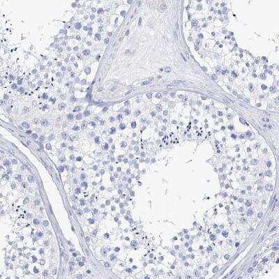 Immunohistochemistry-Paraffin: Filaggrin Antibody [NBP1-87527]