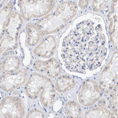 Immunohistochemistry-Paraffin: Filaggrin Antibody [NBP1-87528]
