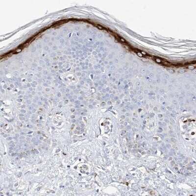 Immunohistochemistry-Paraffin: Filaggrin Antibody [NBP1-87528]