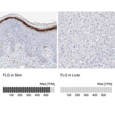 Immunohistochemistry-Paraffin: Filaggrin Antibody [NBP1-87528]