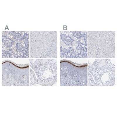 Immunohistochemistry-Paraffin: Filaggrin Antibody [NBP1-87528]