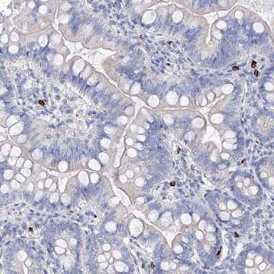 Immunohistochemistry-Paraffin: Filaggrin Antibody [NBP1-87528]