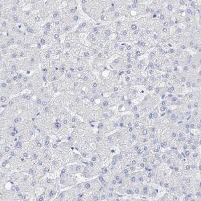 Immunohistochemistry-Paraffin: Filaggrin Antibody [NBP1-87528]