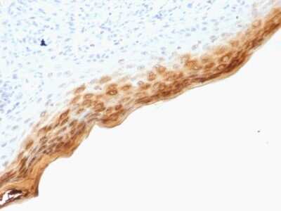 Immunohistochemistry-Paraffin: Filaggrin Antibody (SPM181) [NBP2-53244]