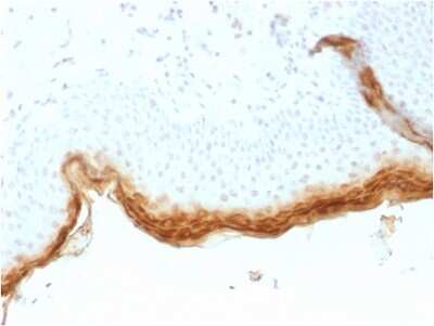 Immunohistochemistry-Paraffin: Filaggrin Antibody (rFLG/1561) - Azide and BSA Free [NBP3-08382]