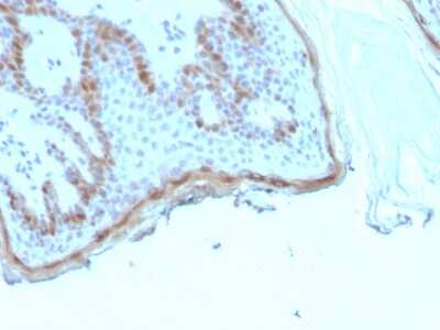 Immunohistochemistry-Paraffin: Filaggrin Antibody (rFLG/1945) [NBP3-13892]