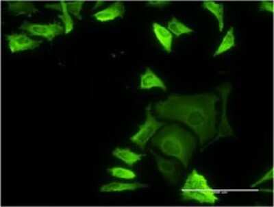 Immunocytochemistry/ Immunofluorescence: Filamin A Antibody (3B6-1D10) [H00002316-M02]