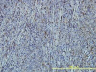 Immunohistochemistry-Paraffin: Filamin A Antibody (4E10-1B2) [H00002316-M01]
