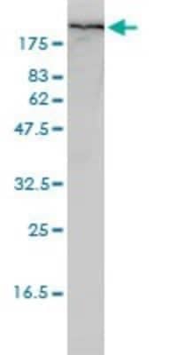 Western Blot: Filamin A Antibody (4E10-1B2) [H00002316-M01]