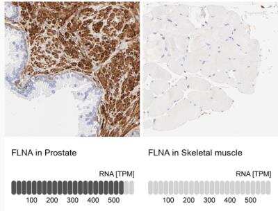 Immunohistochemistry-Paraffin: Filamin A Antibody [NBP1-90283]