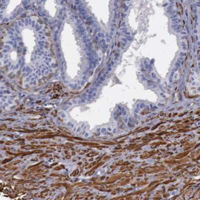 Immunohistochemistry-Paraffin: Filamin A Antibody [NBP1-90284]
