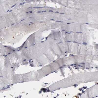 Immunohistochemistry-Paraffin: Filamin A Antibody [NBP1-90284]