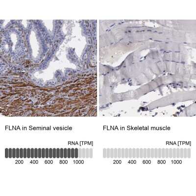 Immunohistochemistry-Paraffin: Filamin A Antibody [NBP1-90284]