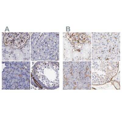 Immunohistochemistry-Paraffin: Filamin A Antibody [NBP1-90284]