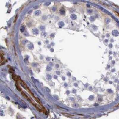 Immunohistochemistry-Paraffin: Filamin A Antibody [NBP1-90284]