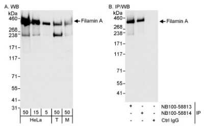 Western Blot: Filamin A Antibody [NB100-58813]