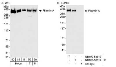 Western Blot: Filamin A Antibody [NB100-58814]