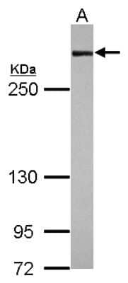 Western Blot: Filamin A Antibody [NBP2-16496]