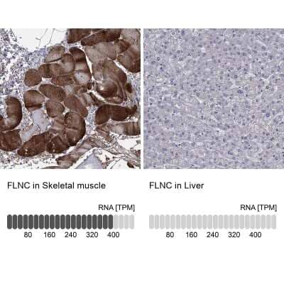 Immunohistochemistry-Paraffin: Filamin Antibody [NBP3-17124]